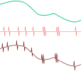 Superposition HF à signal propre BF